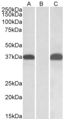 Western Blot: PIM2 Antibody [NBP2-26115]