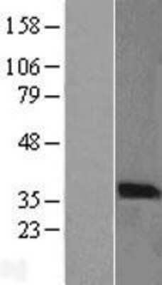 Western Blot: PIM2 Overexpression Lysate [NBL1-14427]