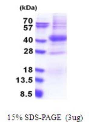 SDS-PAGE: Recombinant Human PIM2 His Protein [NBP2-51711]