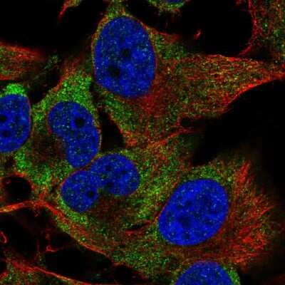 Immunocytochemistry/ Immunofluorescence: PIM3 Antibody [NBP2-55816]