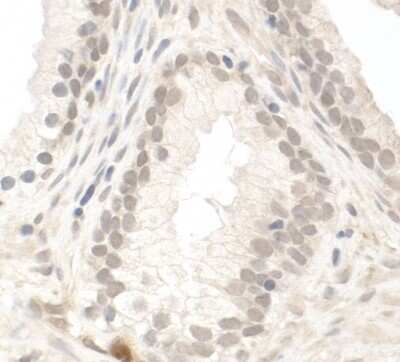Immunohistochemistry: PIMT Antibody [NB100-2595]