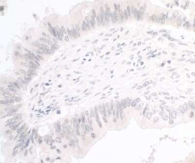Immunohistochemistry: PIMT Antibody [NBP2-44294]