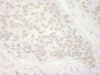 Immunohistochemistry-Paraffin: PIMT Antibody [NB100-2595]