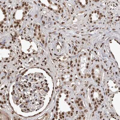 Immunohistochemistry-Paraffin: PIMT Antibody [NBP1-92271]