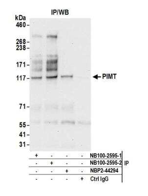 Immunoprecipitation: PIMT Antibody [NB100-2595]