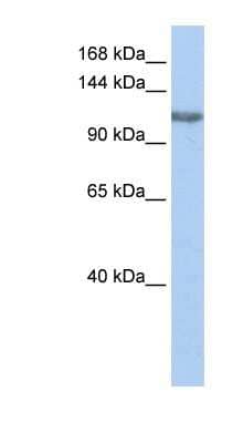 Western Blot: PIMT Antibody [NBP1-54942]