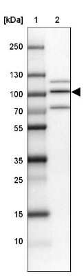 Western Blot: PIMT Antibody [NBP1-92271]