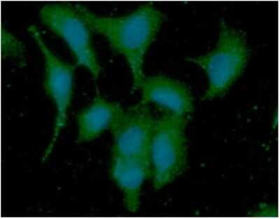 Immunocytochemistry/ Immunofluorescence: PIN/DLC8 Antibody (13C9) - BSA Free [NBP2-59394]