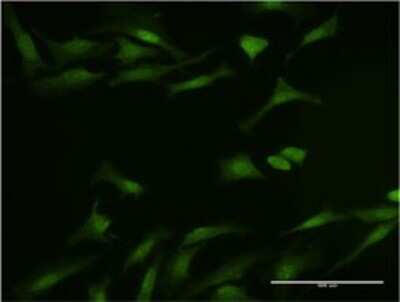 Immunocytochemistry/ Immunofluorescence: PIN/DLC8 Antibody (1H7) [H00008655-M02]