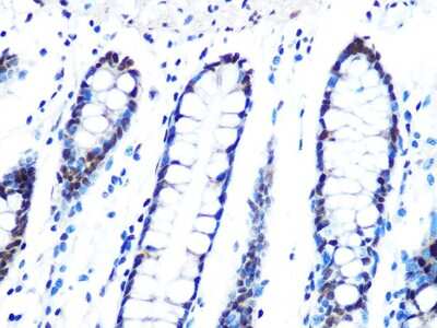 Immunohistochemistry-Paraffin: PIN/DLC8 Antibody (3Q1J6) [NBP3-16386]