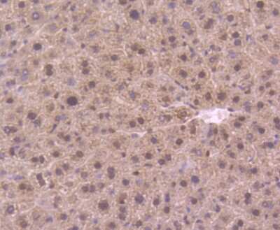 Immunohistochemistry-Paraffin: PIN/DLC8 Antibody (SD08-04) [NBP2-67796]