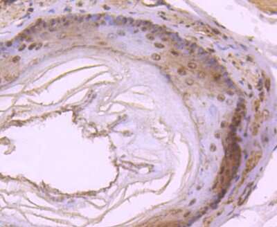 Immunohistochemistry-Paraffin: PIN/DLC8 Antibody (SD08-04) [NBP2-67796]