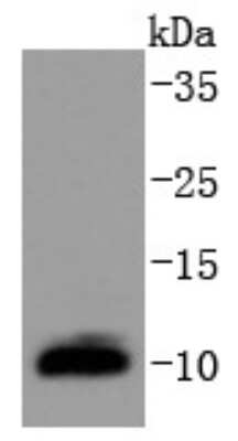 Western Blot: PIN/DLC8 Antibody (SD08-04) [NBP2-67796]