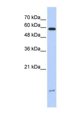 Western Blot: PIN/DLC8 Antibody [NBP1-54949]