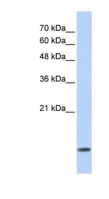 Western Blot: PIN/DLC8 Antibody [NBP1-54970]