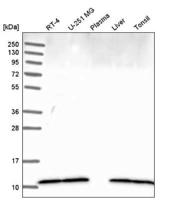 Western Blot: PIN/DLC8 Antibody [NBP2-58509]