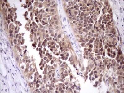 Immunohistochemistry: PIN4 Antibody (OTI7H2) [NBP2-46420]