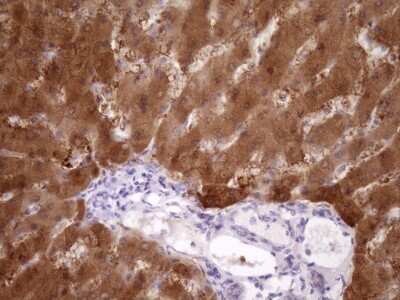 Immunohistochemistry: PIN4 Antibody (OTI7H2) [NBP2-46420]