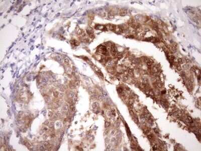 Immunohistochemistry: PIN4 Antibody (OTI7H2) [NBP2-46420]