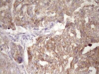 Immunohistochemistry: PIN4 Antibody (OTI7H2) [NBP2-46420]