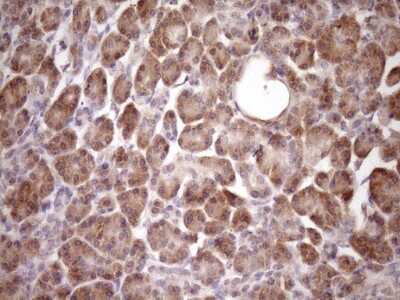Immunohistochemistry: PIN4 Antibody (OTI7H2) [NBP2-46420]