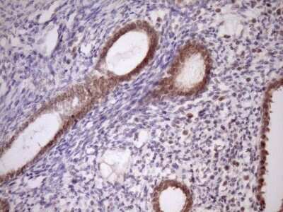 Immunohistochemistry: PIN4 Antibody (OTI7H2) [NBP2-46420]