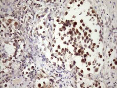 Immunohistochemistry: PIN4 Antibody (OTI7H2) [NBP2-46420]