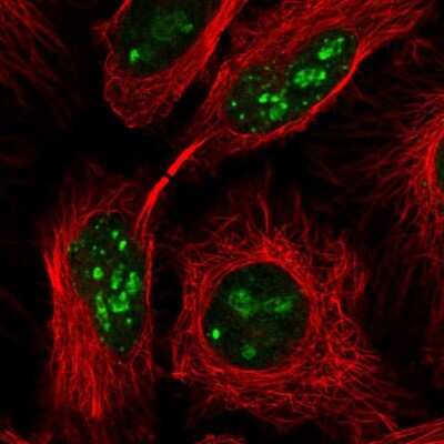 Immunocytochemistry/ Immunofluorescence: PIN4 Antibody [NBP2-49132]