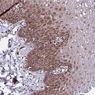 Immunohistochemistry-Paraffin: PIN4 Antibody [NBP2-49132]