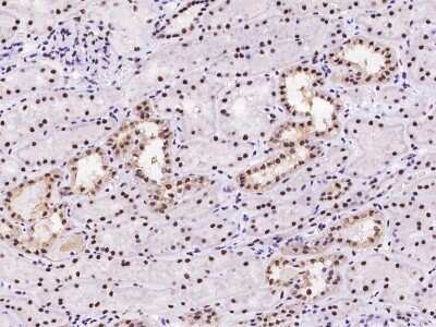 Immunohistochemistry-Paraffin: PIN4 Antibody [NBP2-97273]