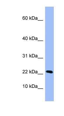 Western Blot: PIN4 Antibody [NBP1-52995]