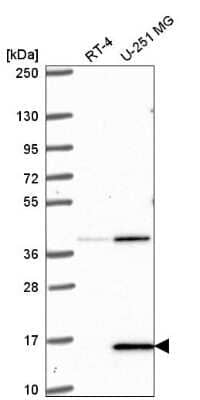 Western Blot: PIN4 Antibody [NBP2-55773]