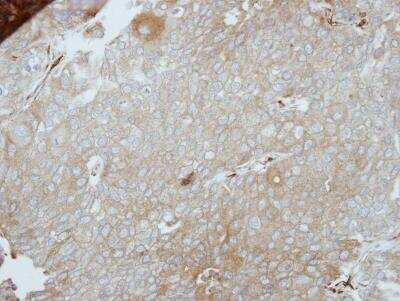 Immunohistochemistry-Paraffin: PINCH1/LIMS1 Antibody [NBP2-19354]
