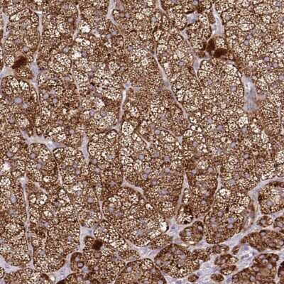 Immunohistochemistry-Paraffin: PINCH1/LIMS1 Antibody [NBP2-46851]