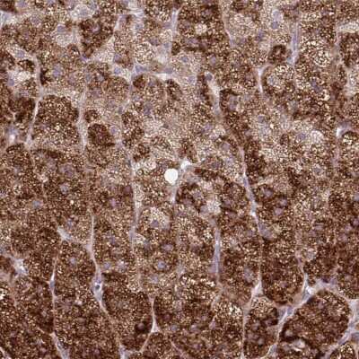 Immunohistochemistry-Paraffin: PINCH1/LIMS1 Antibody [NBP2-56112]