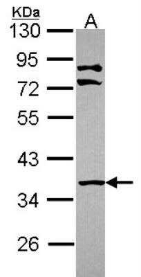 Western Blot: PINCH1/LIMS1 Antibody [NBP2-19354]