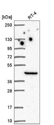 Western Blot: PINCH1/LIMS1 Antibody [NBP2-56112]