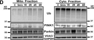 Western Blot Detection of PINK1 in Mitochondrial and Cytosolic Fractions