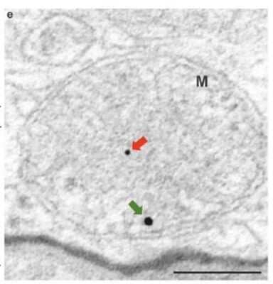 Electron Microscopy Detection of PINK1 in Mouse RPE Cells