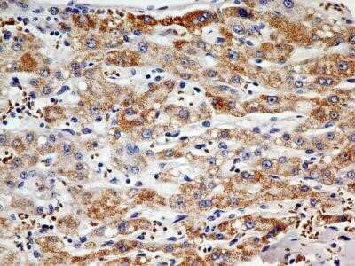 Immunohistochemistry: PINK1 Antibody (8E10.1D6) - Azide and BSA Free [NBP2-80910]