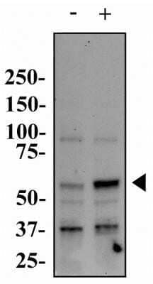 Western Blot: PINK1 Antibody (8E10.1D6)Azide and BSA Free [NBP2-80910]