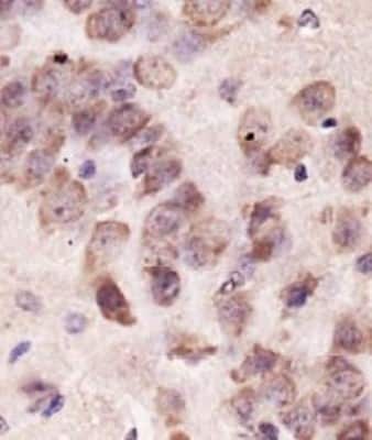 Immunohistochemistry-Paraffin: PINK1 Antibody - BSA Free [NBP1-49678]