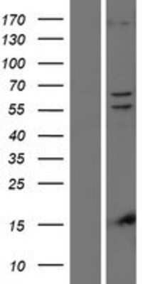 Western Blot: PINK1 Overexpression Lysate [NBP2-06032]