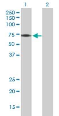 Western Blot: PINK1 293T Cell Transient Overexpression Lysate [H00065018-T02]