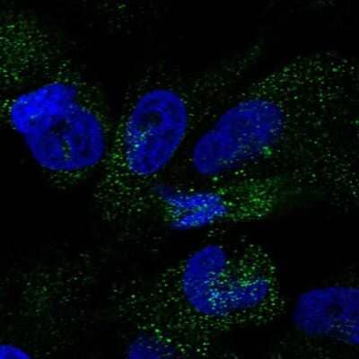 Immunocytochemistry/ Immunofluorescence: PINLYP Antibody [NBP2-32588]