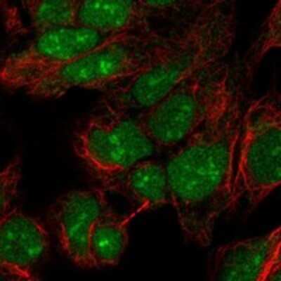 Immunocytochemistry/ Immunofluorescence: PINX1 Antibody [NBP3-17911]