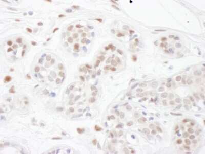 Immunohistochemistry: PINX1 Antibody [NBP2-32265]