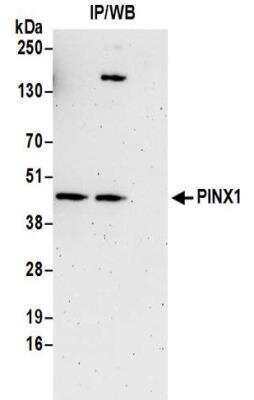 Immunoprecipitation: PINX1 Antibody [NBP2-32265]