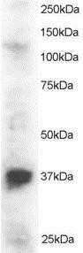 Western Blot: PINX1 Antibody [NB100-890]