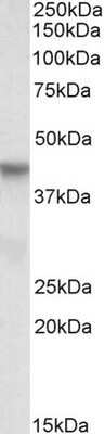 Western Blot: PINX1 Antibody [NBP1-46134]